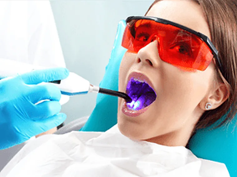 Tooth-Coloured Fillings at Rye Dental Associates in Rye, New York.